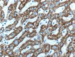 HGS Antibody in Immunohistochemistry (Paraffin) (IHC (P))