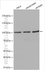 HGS Antibody in Western Blot (WB)