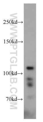 HGS Antibody in Western Blot (WB)