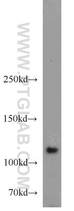 HGS Antibody in Western Blot (WB)