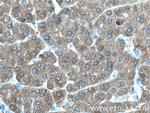 UGP2 Antibody in Immunohistochemistry (Paraffin) (IHC (P))