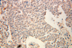 UGP2 Antibody in Immunohistochemistry (Paraffin) (IHC (P))