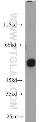 UGP2 Antibody in Western Blot (WB)