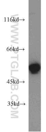 UGP2 Antibody in Western Blot (WB)