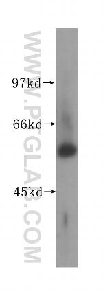 UGP2 Antibody in Western Blot (WB)