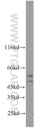 CFLAR/FLIP Antibody in Western Blot (WB)