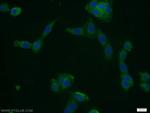 CFLAR/FLIP Antibody in Immunocytochemistry (ICC/IF)