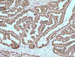 BAP1 Antibody in Immunohistochemistry (Paraffin) (IHC (P))