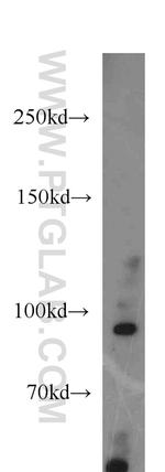 BAP1 Antibody in Western Blot (WB)