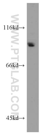 BAP1 Antibody in Western Blot (WB)