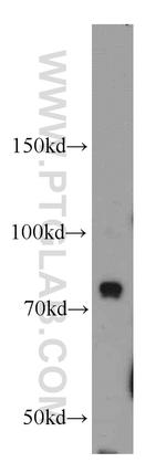 BCAS3 Antibody in Western Blot (WB)