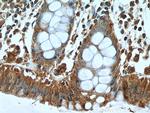 Cytohesin 2 Antibody in Immunohistochemistry (Paraffin) (IHC (P))