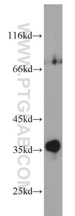 Syntenin 2 Antibody in Western Blot (WB)