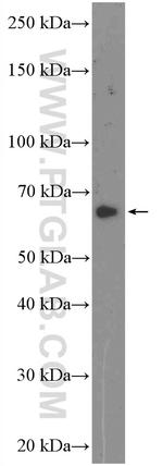 GAD1 Antibody in Western Blot (WB)