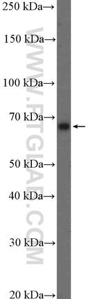 GAD1 Antibody in Western Blot (WB)