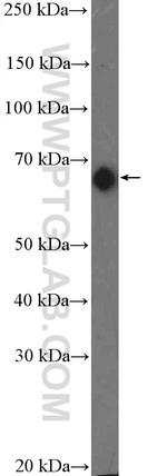 GAD1 Antibody in Western Blot (WB)