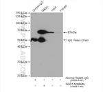 GAD1 Antibody in Immunoprecipitation (IP)