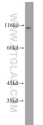 NFKB2 Antibody in Western Blot (WB)