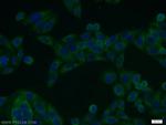 NFKB2 Antibody in Immunocytochemistry (ICC/IF)