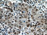 NFKB2 Antibody in Immunohistochemistry (Paraffin) (IHC (P))