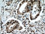 NFKB2 Antibody in Immunohistochemistry (Paraffin) (IHC (P))