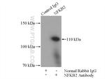 NFKB2 Antibody in Immunoprecipitation (IP)