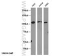 NFKB2 Antibody in Western Blot (WB)