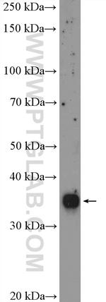 RFC2 Antibody in Western Blot (WB)