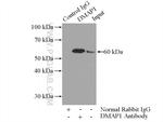 DMAP1 Antibody in Immunoprecipitation (IP)