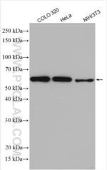 DMAP1 Antibody in Western Blot (WB)