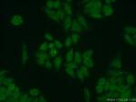 RPA2 Antibody in Immunocytochemistry (ICC/IF)