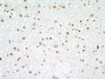 RPA2 Antibody in Immunohistochemistry (Paraffin) (IHC (P))