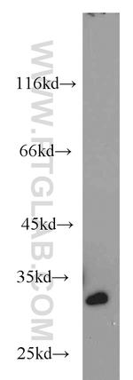 RPA2 Antibody in Western Blot (WB)