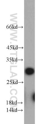 RPA2 Antibody in Western Blot (WB)