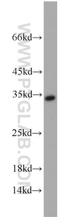 RPA2 Antibody in Western Blot (WB)