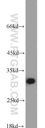 RPA2 Antibody in Western Blot (WB)