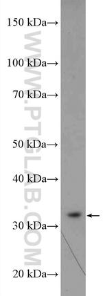 RPA2 Antibody in Western Blot (WB)