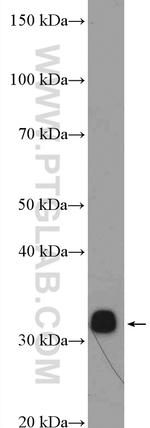 RPA2 Antibody in Western Blot (WB)