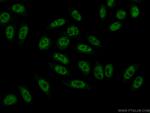 BCAS2 Antibody in Immunocytochemistry (ICC/IF)