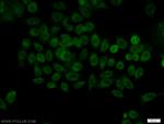 BCAS2 Antibody in Immunocytochemistry (ICC/IF)