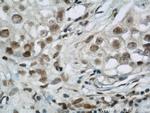 BCAS2 Antibody in Immunohistochemistry (Paraffin) (IHC (P))