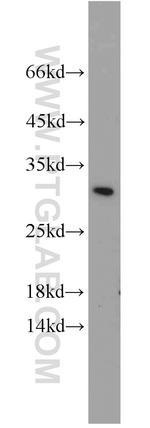 BCAS2 Antibody in Western Blot (WB)