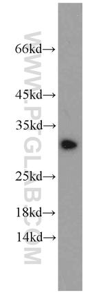 BCAS2 Antibody in Western Blot (WB)