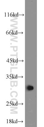 BCAS2 Antibody in Western Blot (WB)