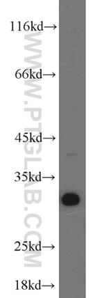 BCAS2 Antibody in Western Blot (WB)