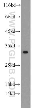 BCAS2 Antibody in Western Blot (WB)