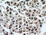 GATA3 Antibody in Immunohistochemistry (Paraffin) (IHC (P))