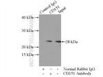 CD151 Antibody in Immunoprecipitation (IP)