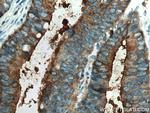 CEA Antibody in Immunohistochemistry (Paraffin) (IHC (P))