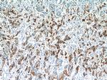 CEA Antibody in Immunohistochemistry (Paraffin) (IHC (P))